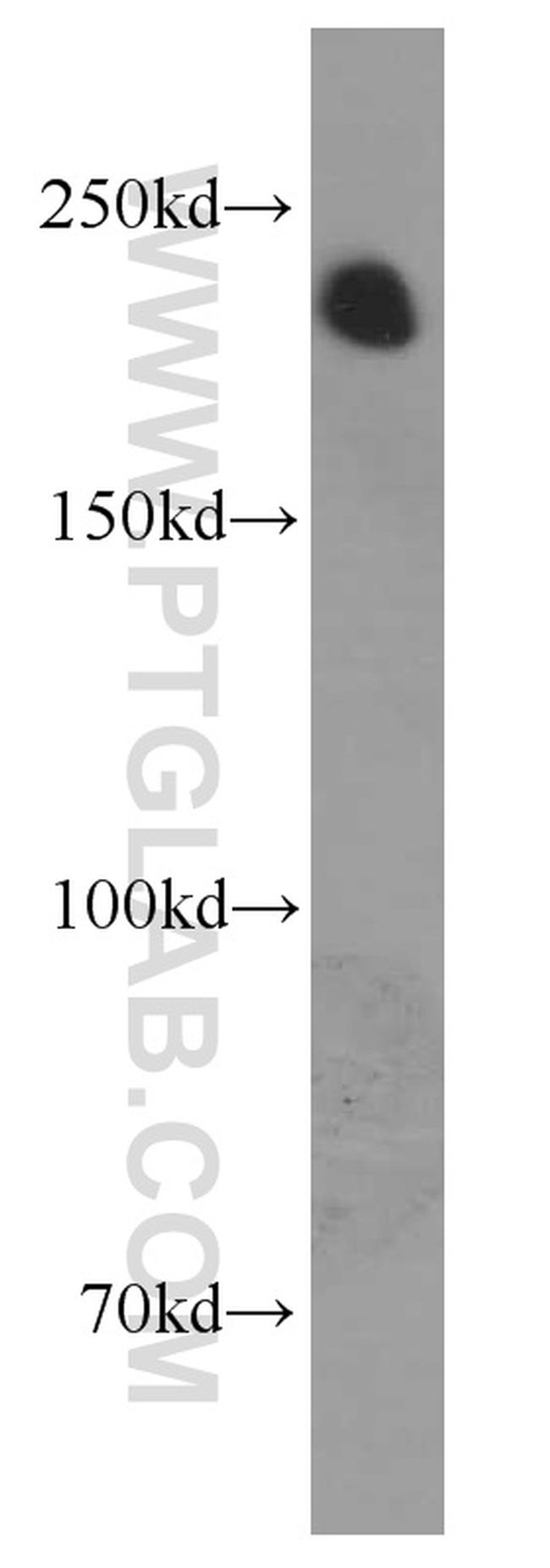 NF-H Antibody in Western Blot (WB)