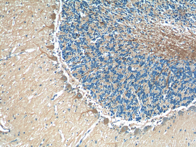 TMEM106B Antibody in Immunohistochemistry (Paraffin) (IHC (P))