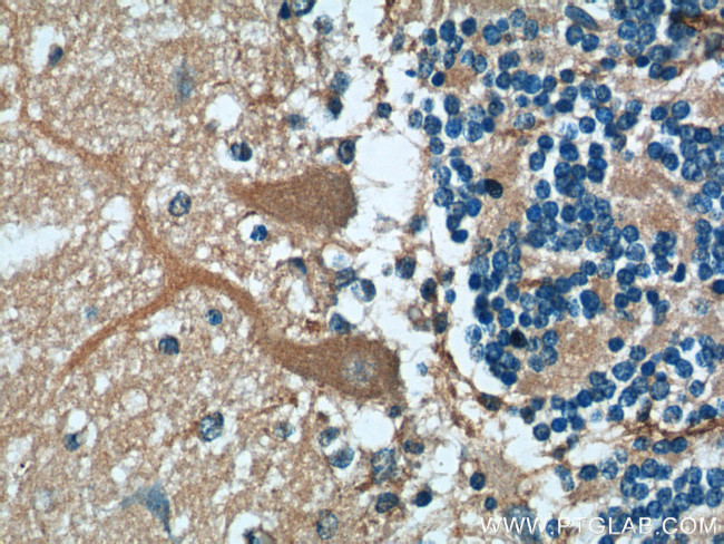 TMEM106B Antibody in Immunohistochemistry (Paraffin) (IHC (P))