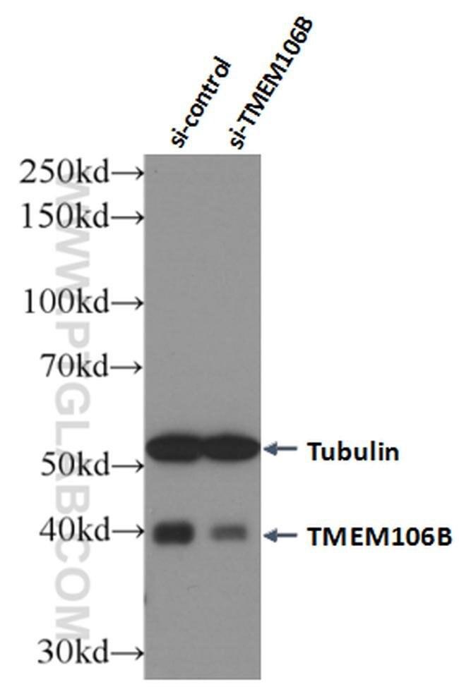 TMEM106B Antibody in Western Blot (WB)