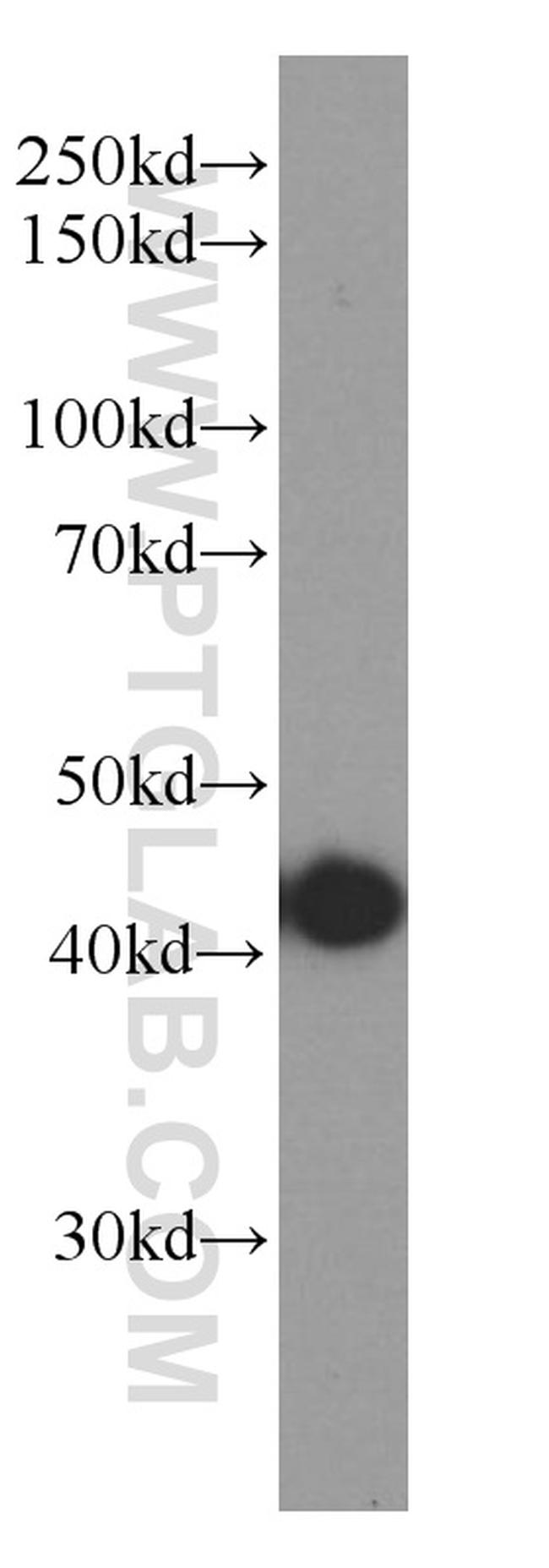 TMEM106B Antibody in Western Blot (WB)