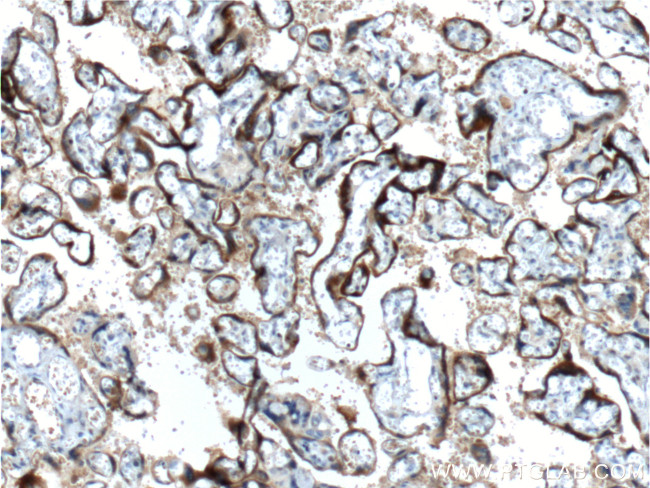 hCG beta Antibody in Immunohistochemistry (Paraffin) (IHC (P))