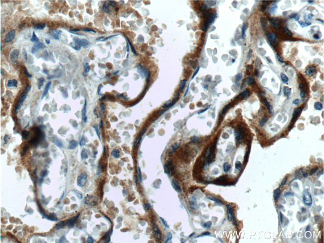 hCG beta Antibody in Immunohistochemistry (Paraffin) (IHC (P))