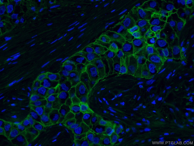 E-cadherin Antibody in Immunohistochemistry (PFA fixed) (IHC (PFA))