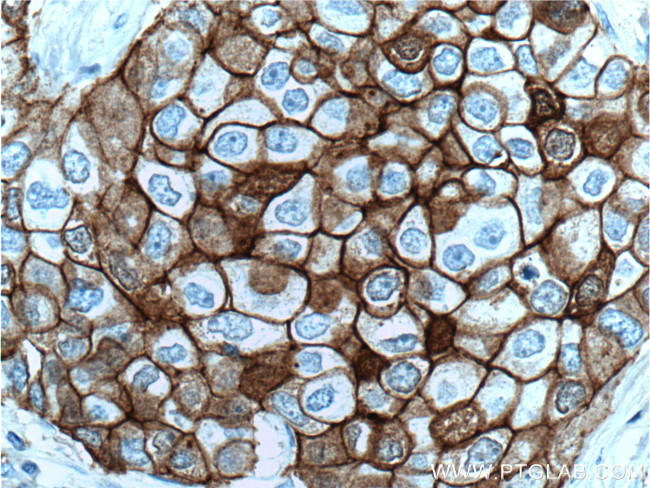 E-cadherin Antibody in Immunohistochemistry (Paraffin) (IHC (P))