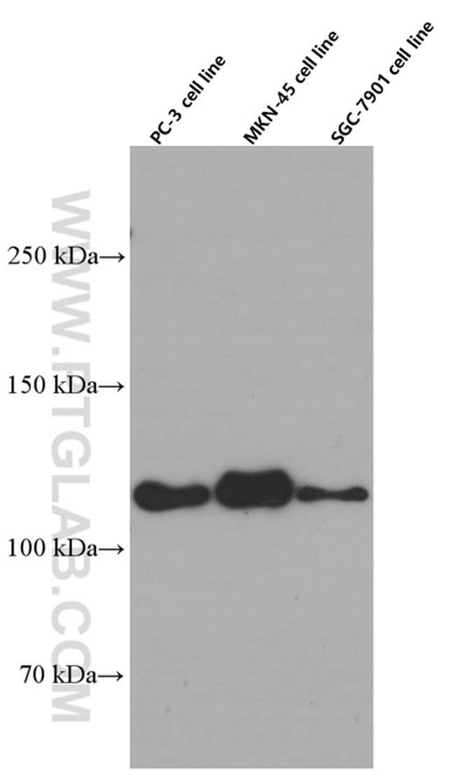 E-cadherin Antibody in Western Blot (WB)