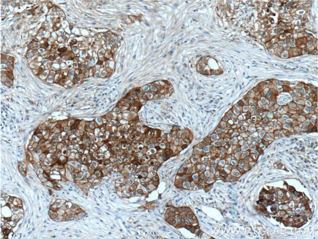 E-cadherin Antibody in Immunohistochemistry (Paraffin) (IHC (P))