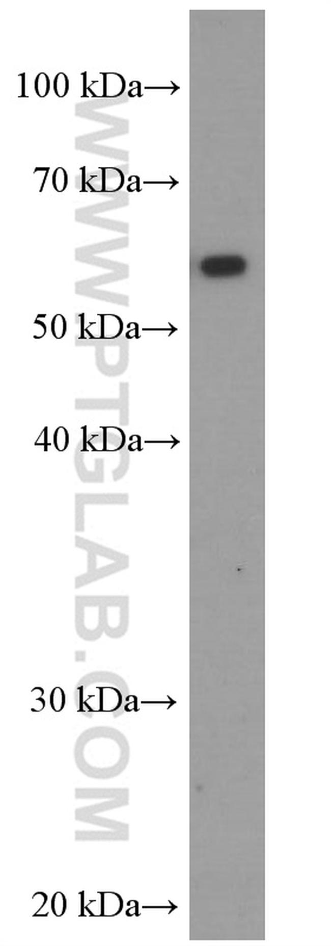 HEXA Antibody in Western Blot (WB)