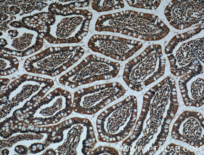 CX3CL1 Antibody in Immunohistochemistry (Paraffin) (IHC (P))