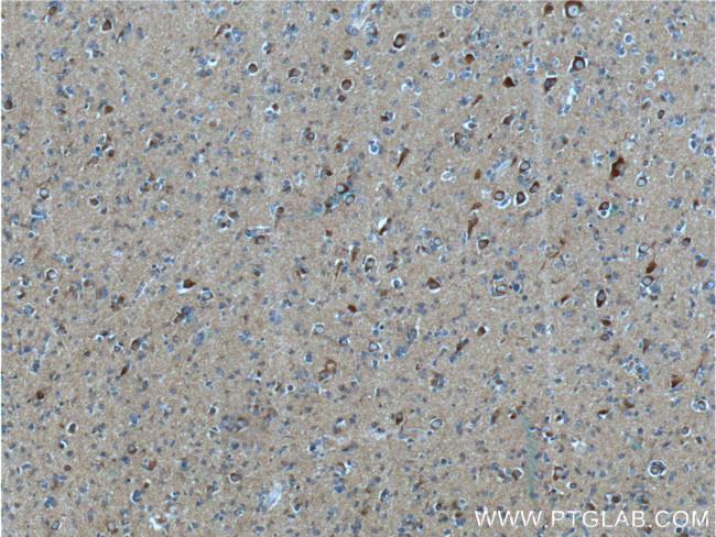 beta Amyloid Antibody in Immunohistochemistry (Paraffin) (IHC (P))