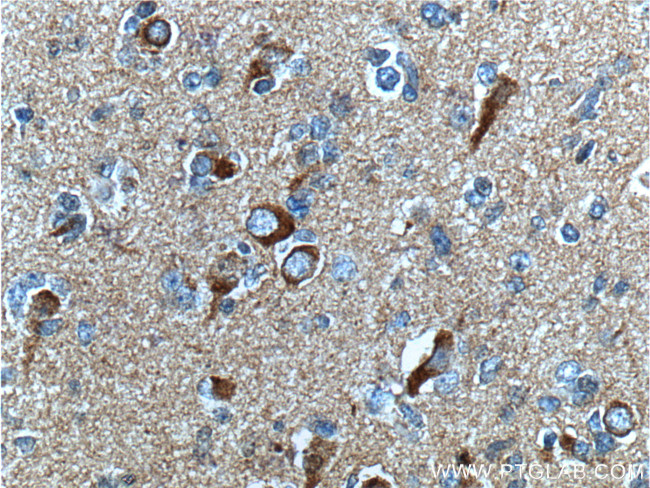 beta Amyloid Antibody in Immunohistochemistry (Paraffin) (IHC (P))