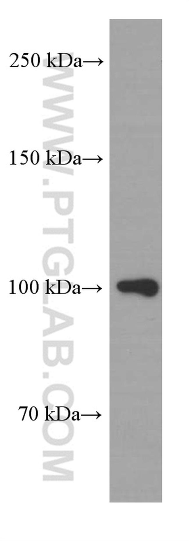 beta Amyloid Antibody in Western Blot (WB)