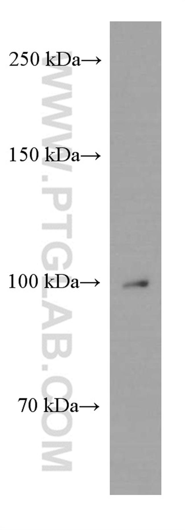 beta Amyloid Antibody in Western Blot (WB)