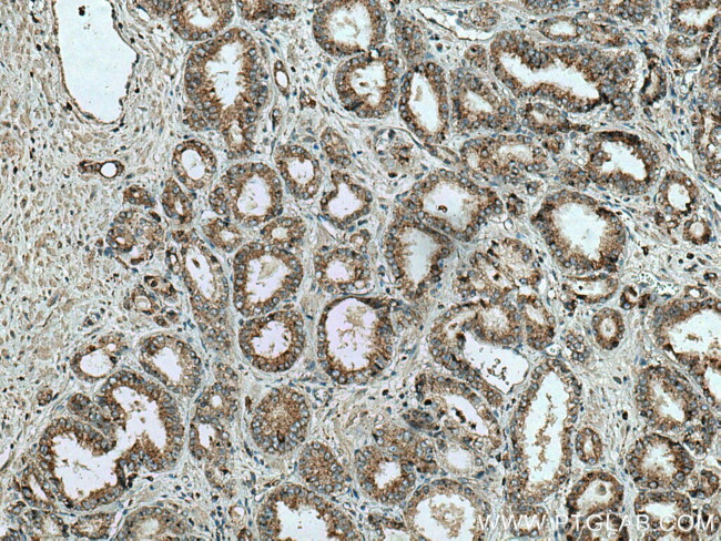 Prostein Antibody in Immunohistochemistry (Paraffin) (IHC (P))