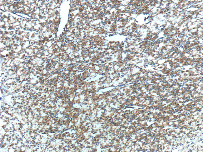 Prostein Antibody in Immunohistochemistry (Paraffin) (IHC (P))