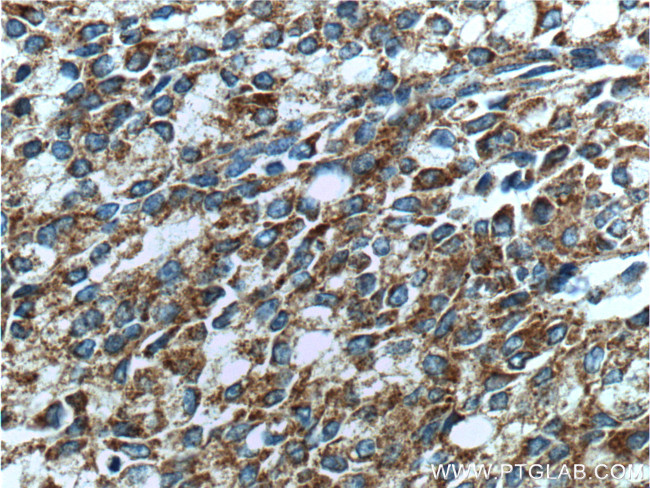 Prostein Antibody in Immunohistochemistry (Paraffin) (IHC (P))