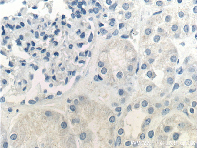 Prostein Antibody in Immunohistochemistry (Paraffin) (IHC (P))