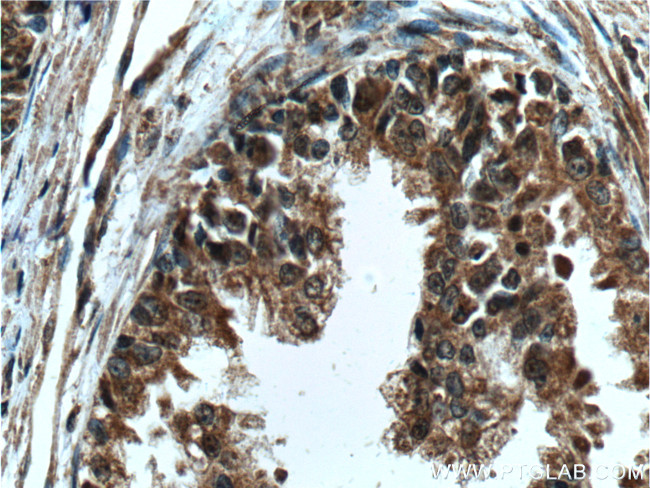 LIN28 Antibody in Immunohistochemistry (Paraffin) (IHC (P))