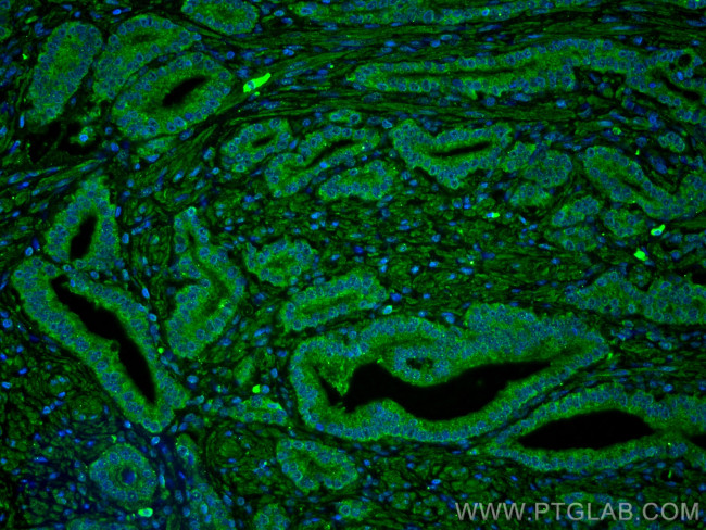 LIN28 Antibody in Immunohistochemistry (PFA fixed) (IHC (PFA))