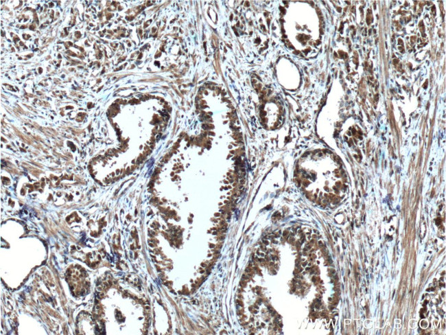 LIN28 Antibody in Immunohistochemistry (Paraffin) (IHC (P))