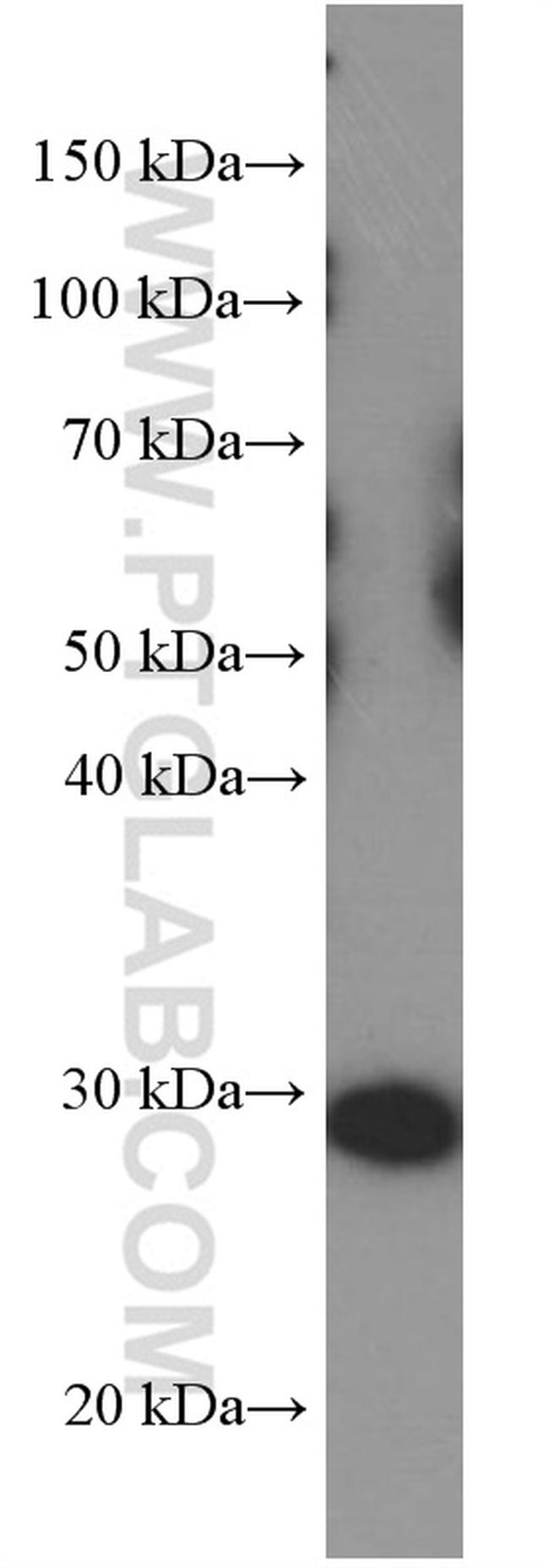 LIN28 Antibody in Western Blot (WB)