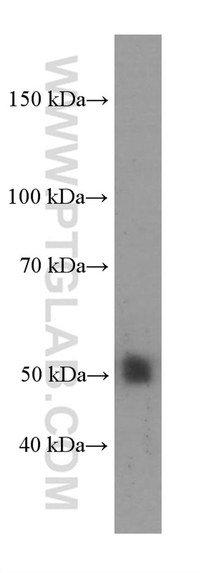 NR1H2 Antibody in Western Blot (WB)