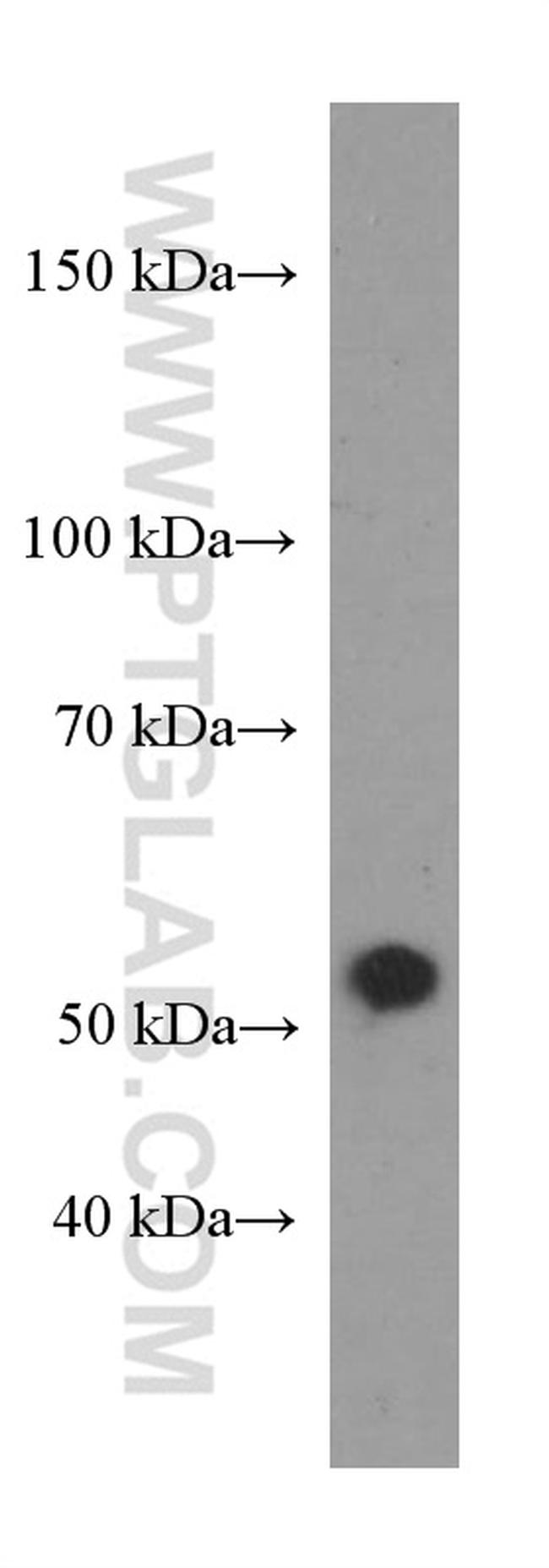 NR1H2 Antibody in Western Blot (WB)