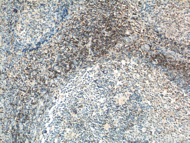 CD3 gamma Antibody in Immunohistochemistry (Paraffin) (IHC (P))