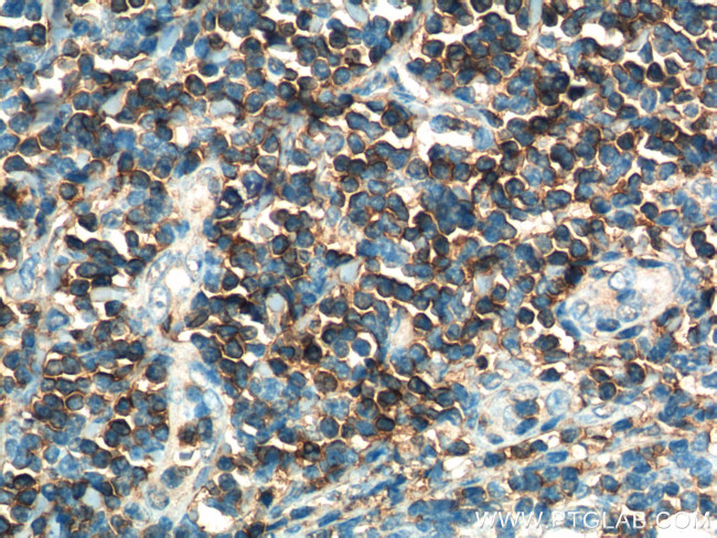 CD3 gamma Antibody in Immunohistochemistry (Paraffin) (IHC (P))