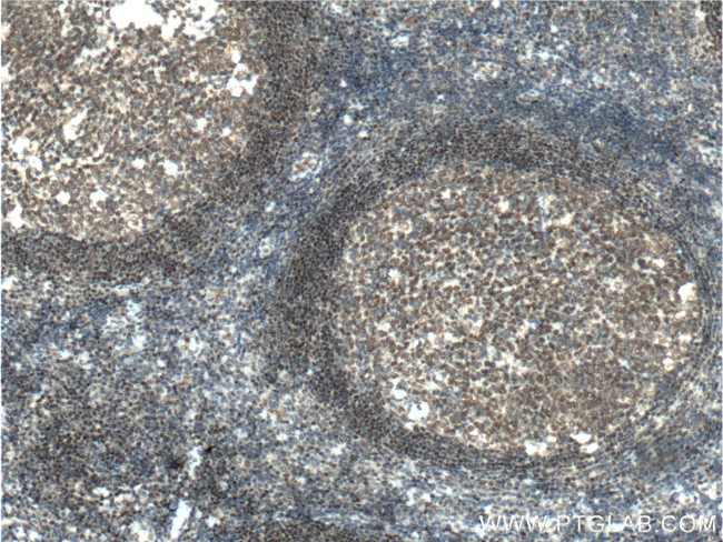 BSAP/PAX5 Antibody in Immunohistochemistry (Paraffin) (IHC (P))