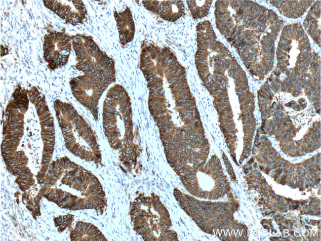 Cadherin-17 Antibody in Immunohistochemistry (Paraffin) (IHC (P))