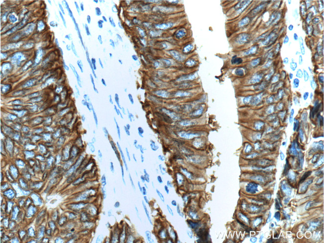 Cadherin-17 Antibody in Immunohistochemistry (Paraffin) (IHC (P))