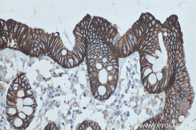 Cadherin-17 Antibody in Immunohistochemistry (Paraffin) (IHC (P))