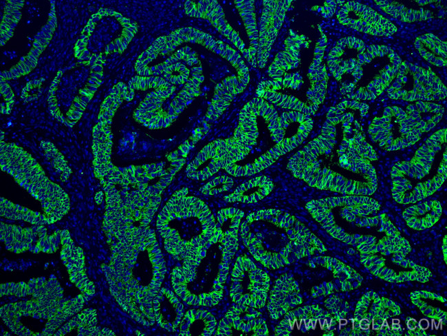 Cadherin-17 Antibody in Immunohistochemistry (PFA fixed) (IHC (PFA))