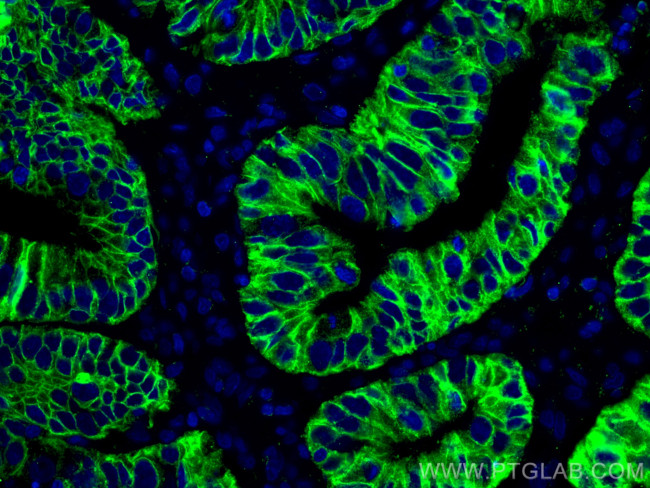 Cadherin-17 Antibody in Immunohistochemistry (PFA fixed) (IHC (PFA))