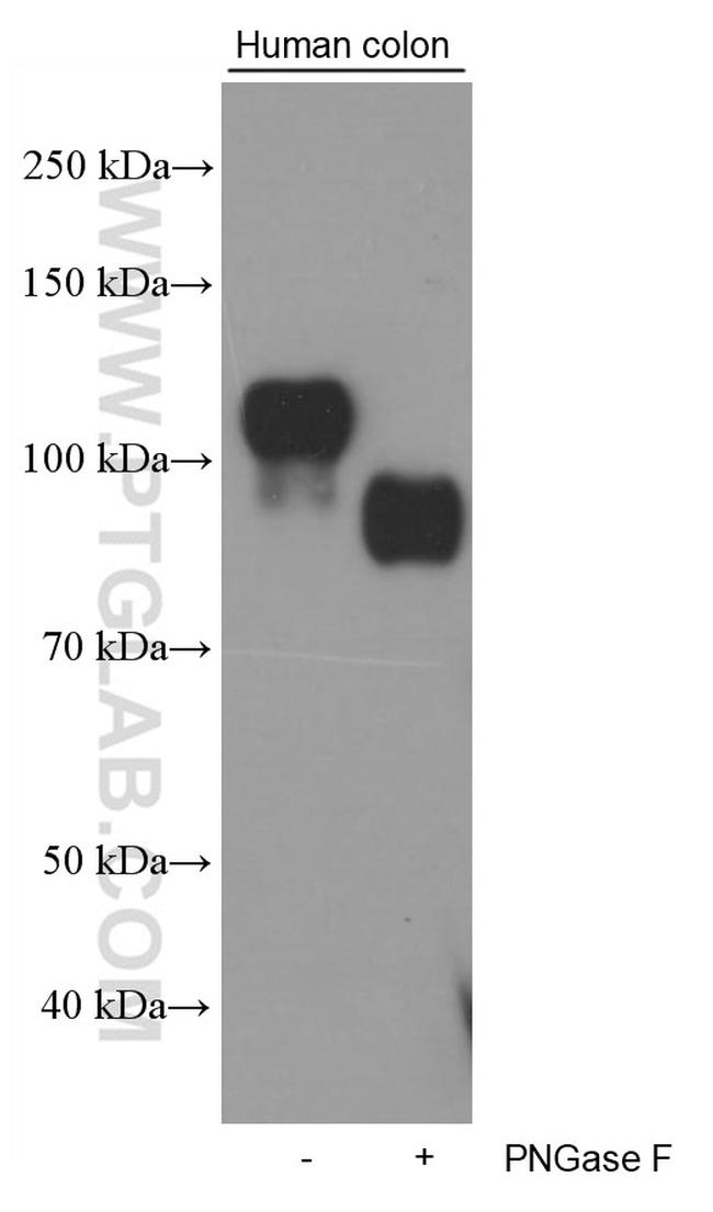 Cadherin-17 Antibody in Western Blot (WB)