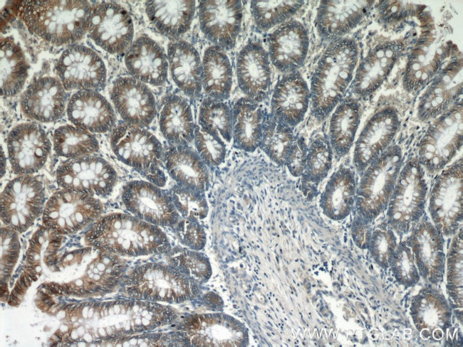 Cadherin-17 Antibody in Immunohistochemistry (Paraffin) (IHC (P))