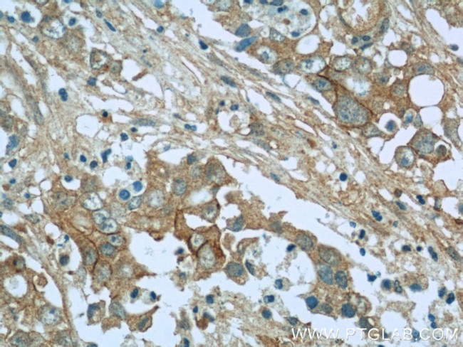 Cadherin-17 Antibody in Immunohistochemistry (Paraffin) (IHC (P))