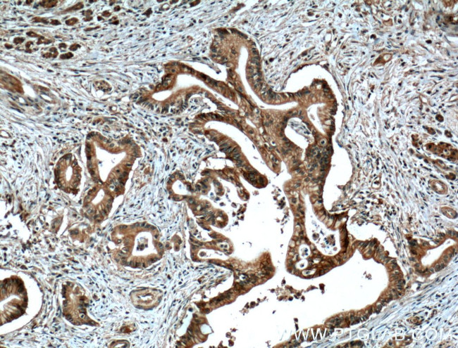 Cadherin-17 Antibody in Immunohistochemistry (Paraffin) (IHC (P))