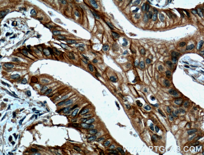 Cadherin-17 Antibody in Immunohistochemistry (Paraffin) (IHC (P))