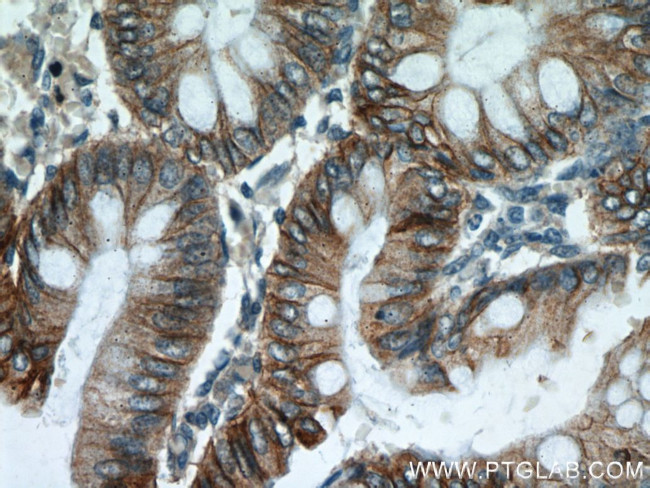 Cadherin-17 Antibody in Immunohistochemistry (Paraffin) (IHC (P))