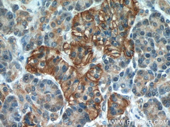 Cadherin-17 Antibody in Immunohistochemistry (Paraffin) (IHC (P))