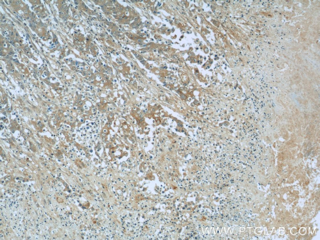 Cadherin-17 Antibody in Immunohistochemistry (Paraffin) (IHC (P))