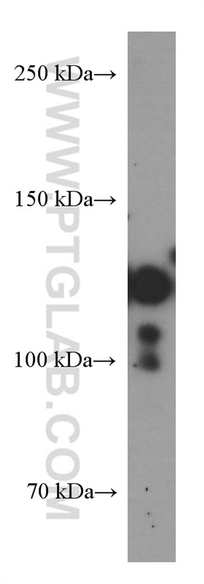 Cadherin-17 Antibody in Western Blot (WB)