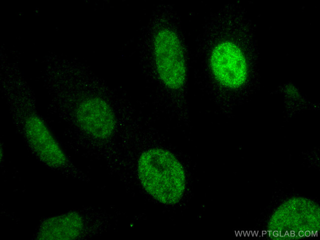 MUM1 Antibody in Immunocytochemistry (ICC/IF)