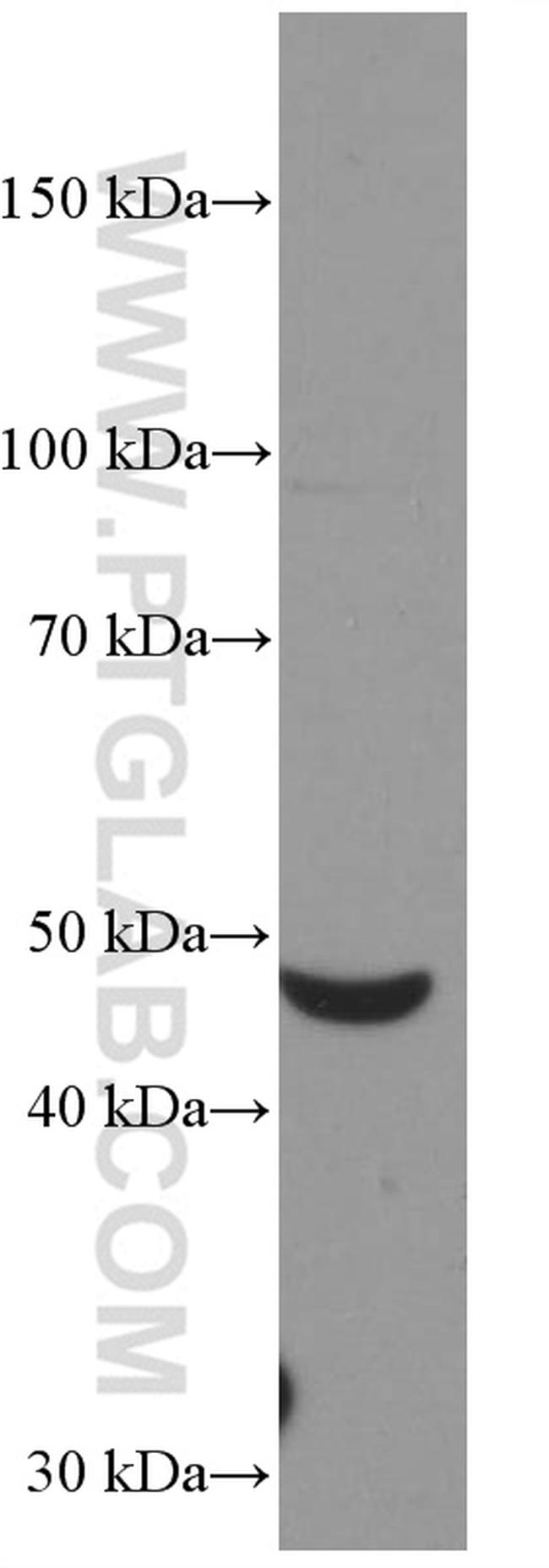 Myocilin Antibody in Western Blot (WB)