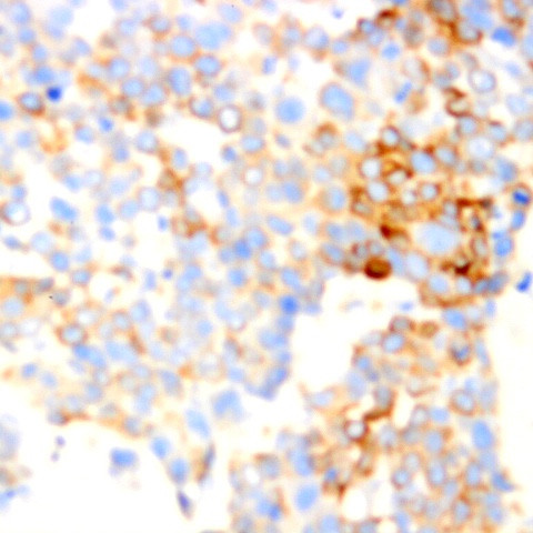 A2B5 Antibody in Immunohistochemistry (Paraffin) (IHC (P))