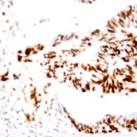 AID Antibody in Immunohistochemistry (Paraffin) (IHC (P))