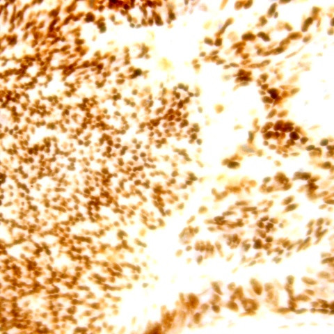 Aurora A Kinase Antibody in Immunohistochemistry (Paraffin) (IHC (P))