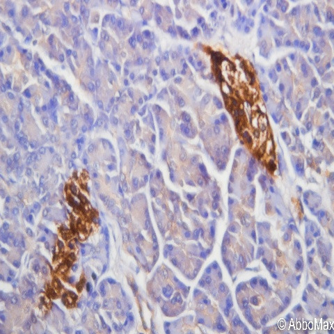 PAX6 Antibody in Immunohistochemistry (Paraffin) (IHC (P))